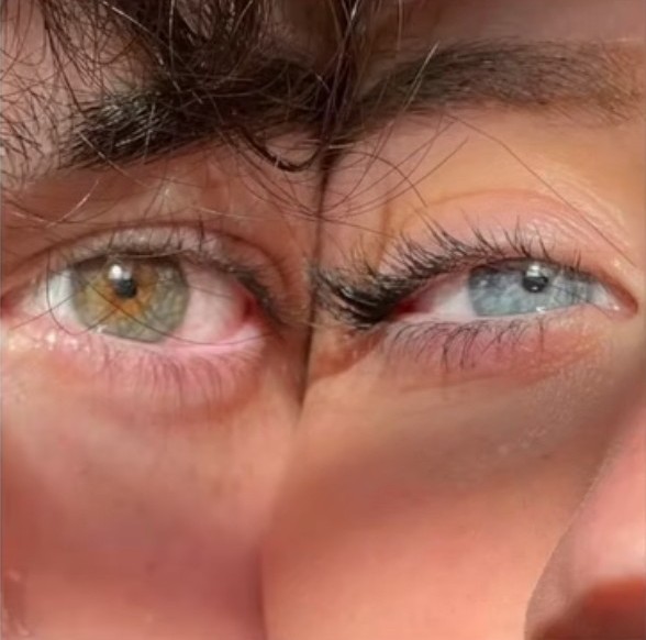 Hatice katiturk / KAPALI KIZ VE FUTBOLCU. / DrKONU GÖZLERİN. . .